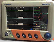Goldway UT4000Apro 12.1 ইঞ্চি TFT ডিসপ্লে সহ রোগীর মনিটর ব্যবহার করেছে